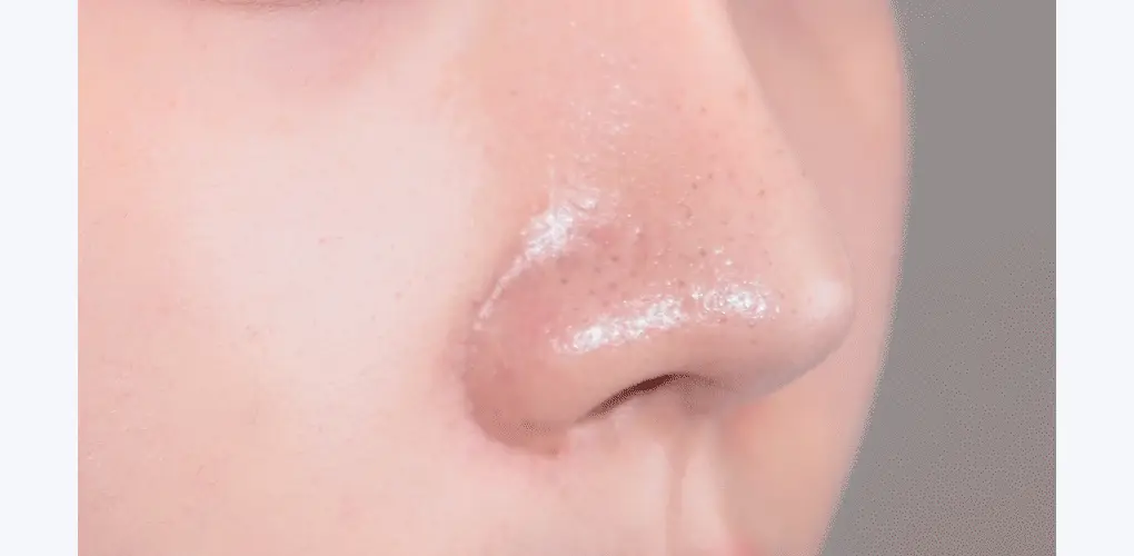 [블랙헤드관리/김다혜PICK] 비프로젝트 바이 블랙헤드 멜팅 리무버 30ml 상세페이지 4
